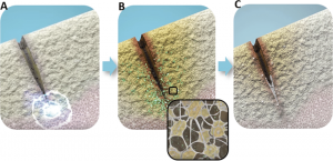 Three images of human bone and their flexoelectric fields